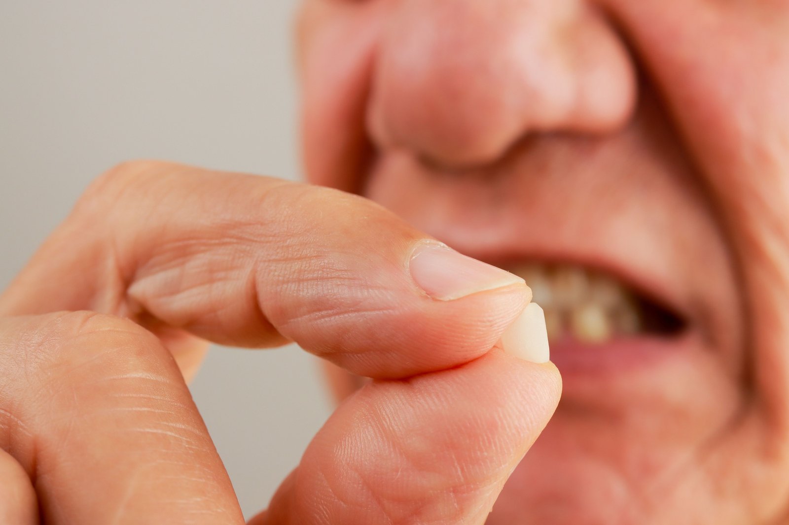 file man demonstrating his chipped tooth between his fingers | Pearly Whites London
