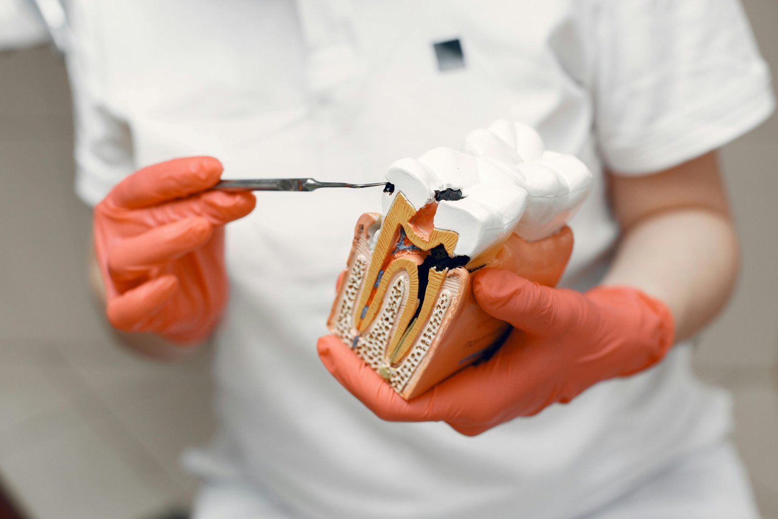 Close-up of dentist holding a tooth model, illustrating dental care concepts. - Root Canal
