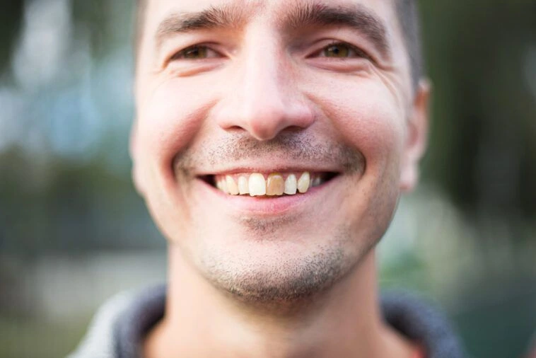 file discoloured | Pearly Whites London